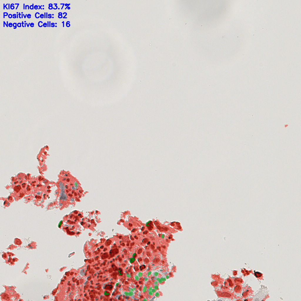 slice_15_10_x13440_y8960.png