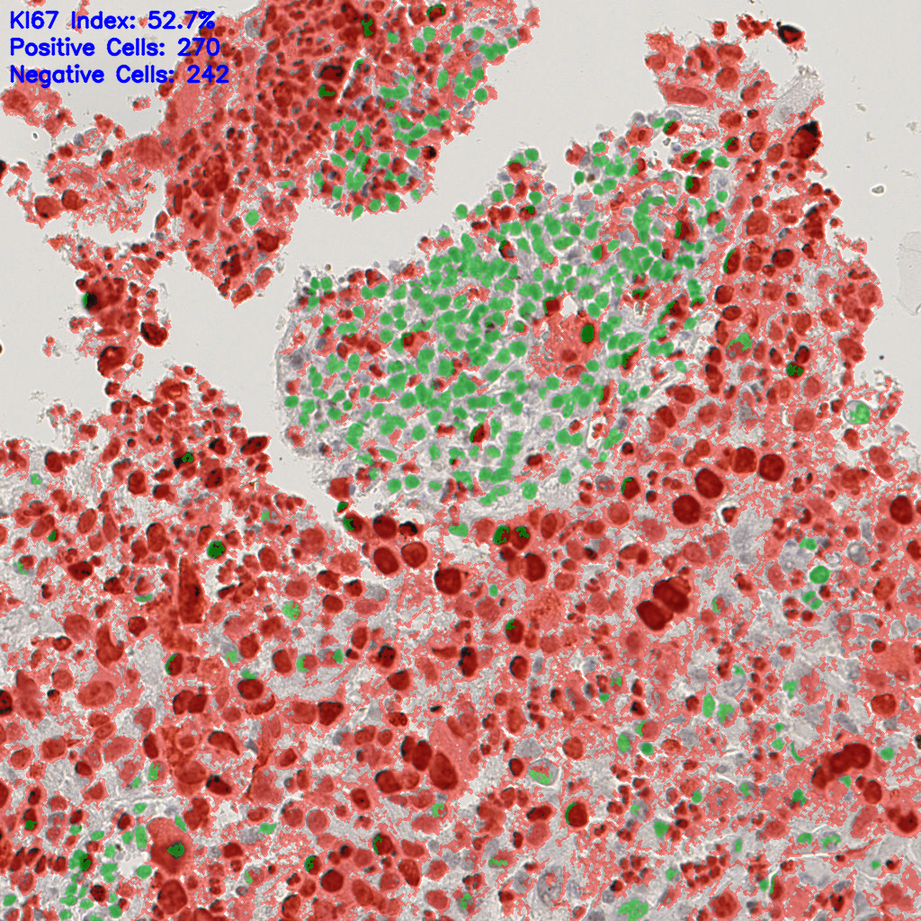 slice_15_11_x13440_y9856.png