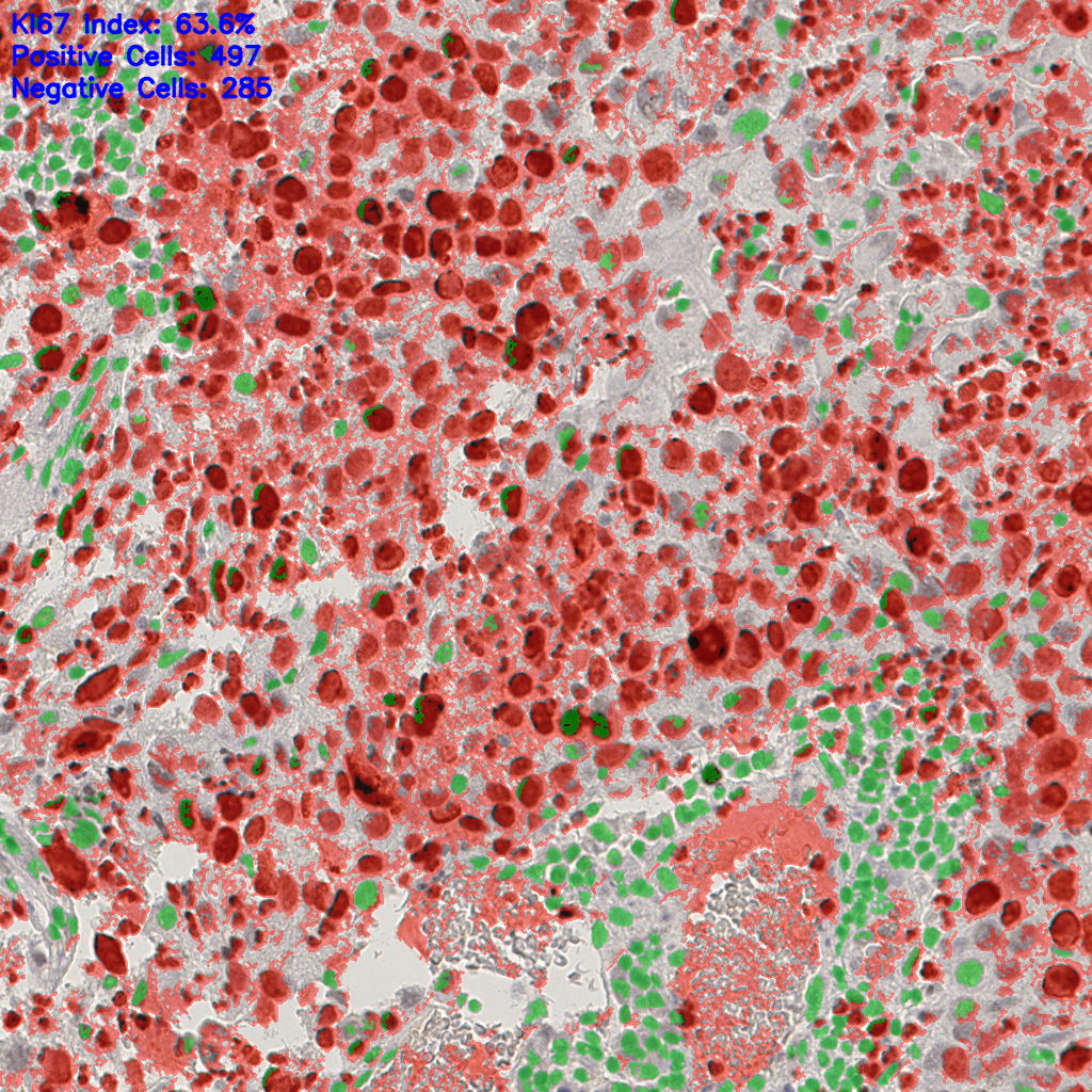 slice_15_12_x13440_y10752.png