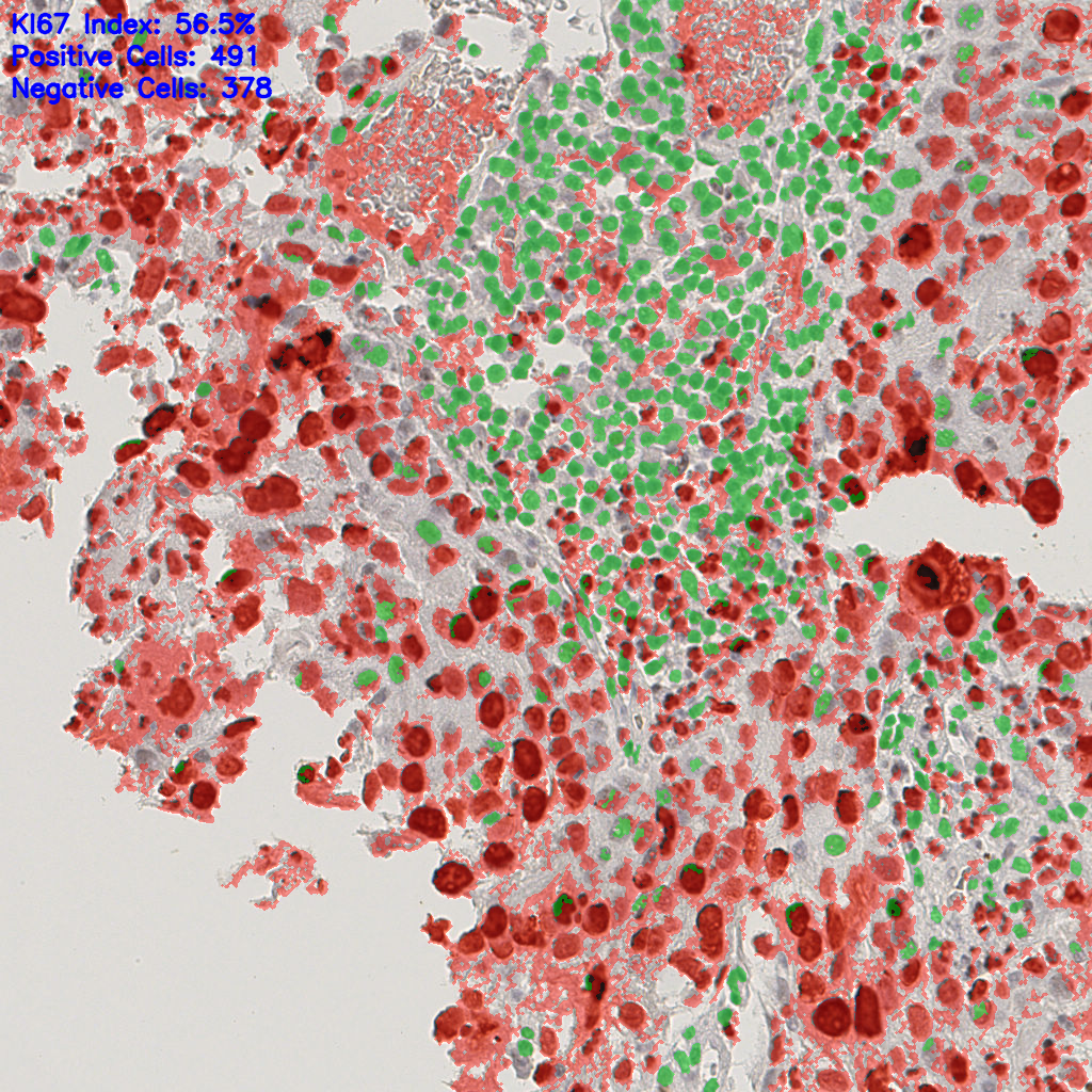 slice_15_13_x13440_y11648.png