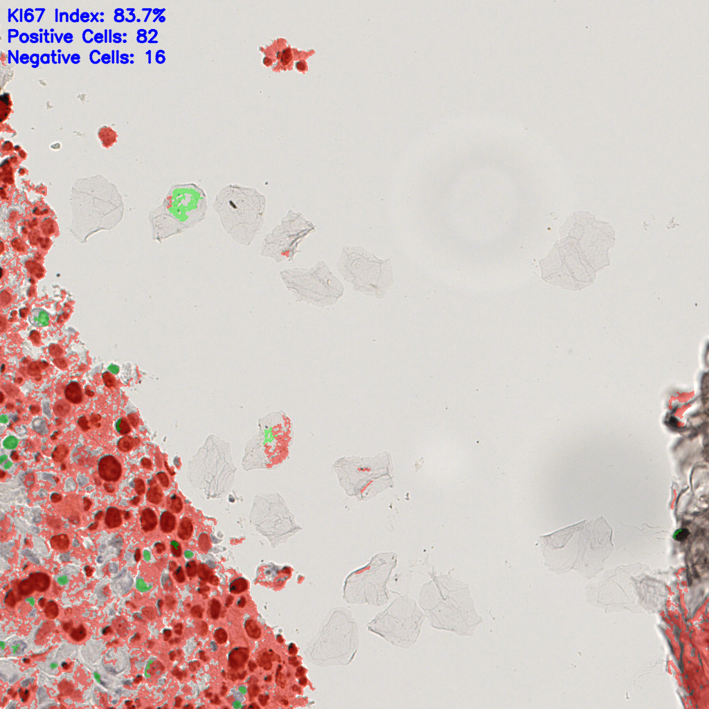 slice_16_11_x14336_y9856.png