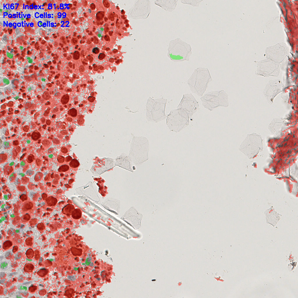 slice_16_12_x14336_y10752.png