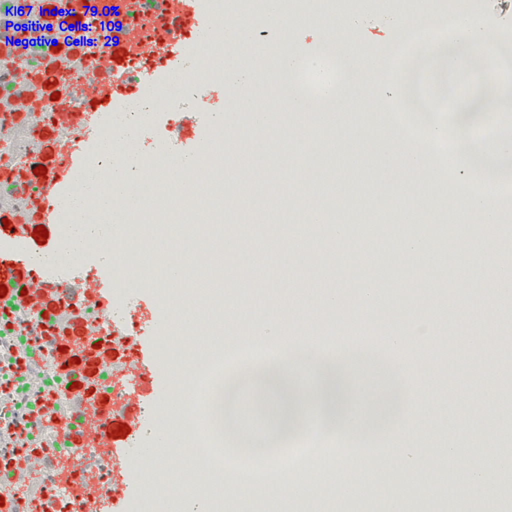 slice_16_13_x14336_y11648.png