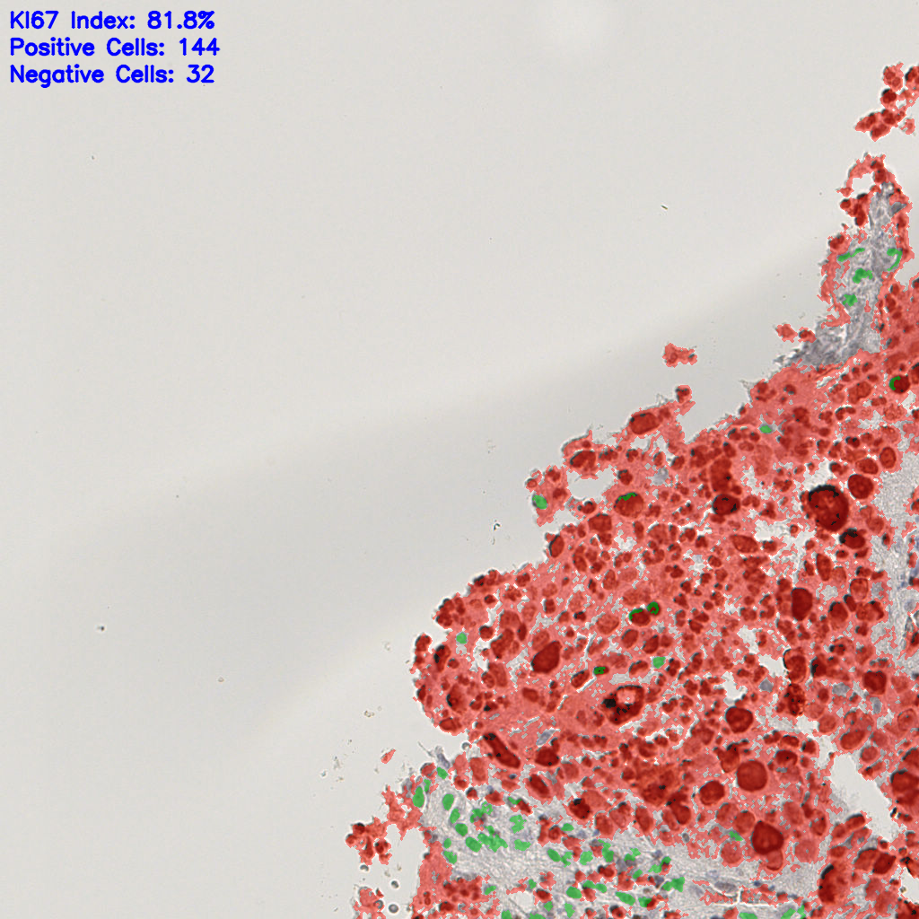 slice_16_16_x14336_y14336.png