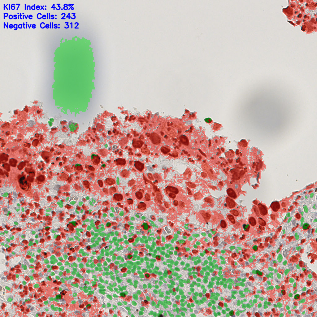slice_16_18_x14336_y16128.png