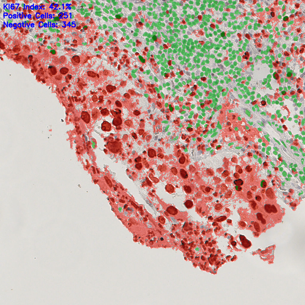 slice_16_19_x14336_y17024.png