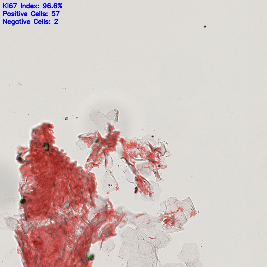 slice_17_11_x15232_y9856.png