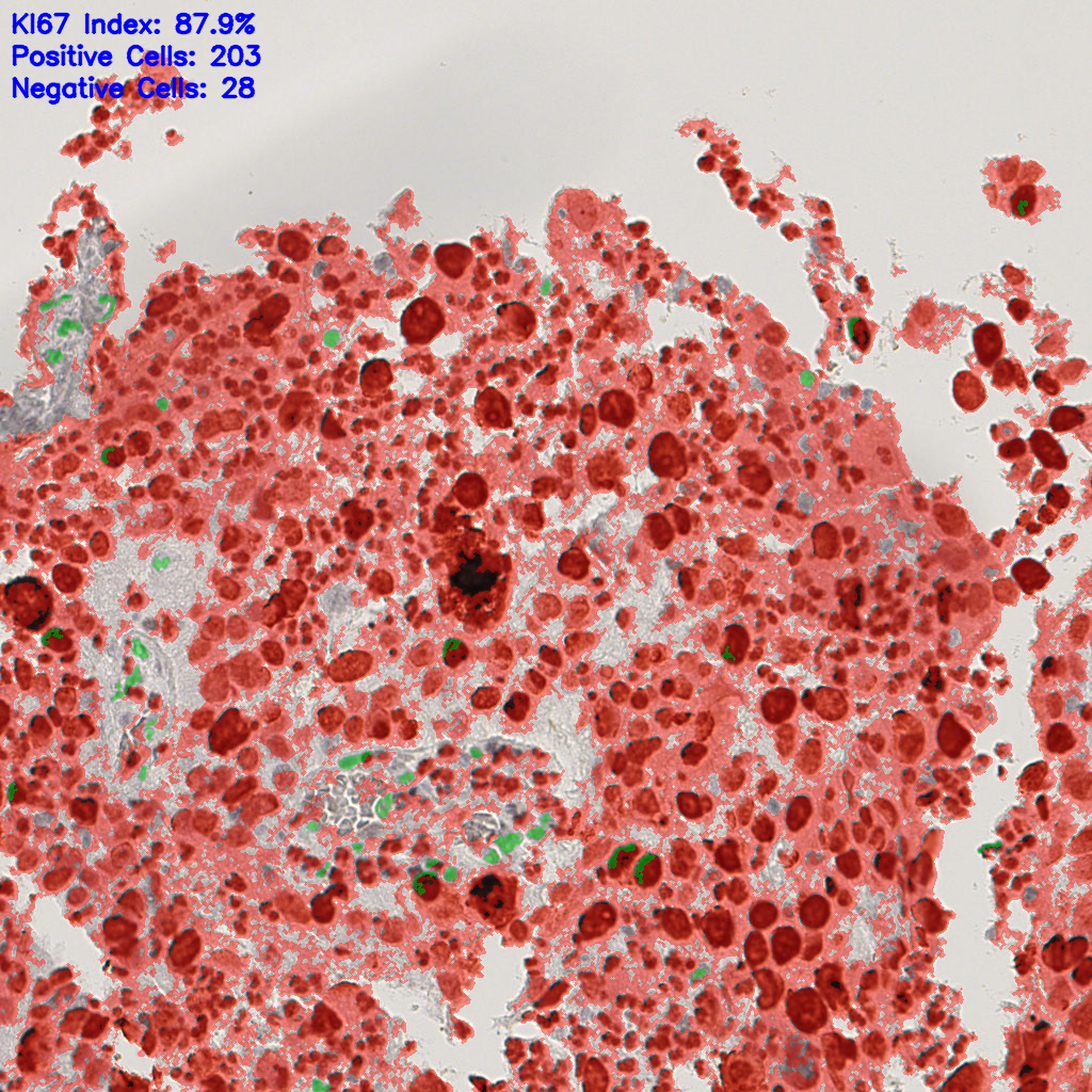 slice_17_16_x15232_y14336.png