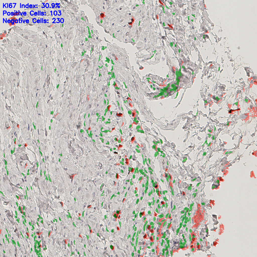 slice_17_30_x15232_y26880.png