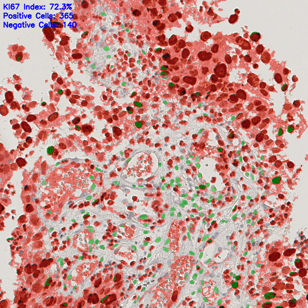 slice_18_16_x16128_y14336.png