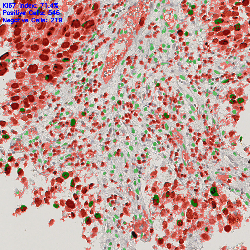 slice_18_17_x16128_y15232.png