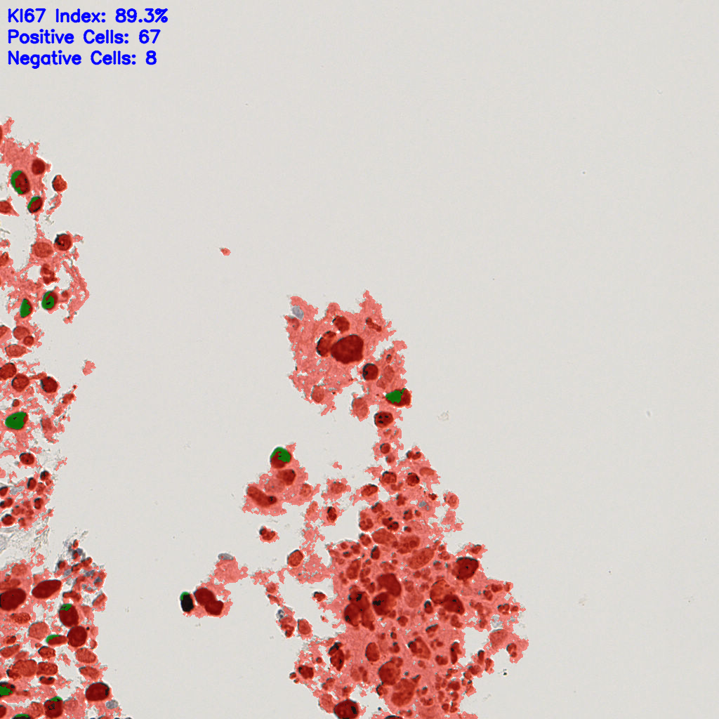 slice_19_16_x17024_y14336.png
