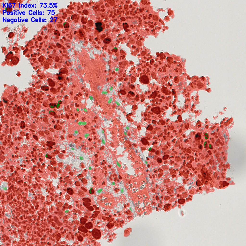 slice_19_18_x17024_y16128.png