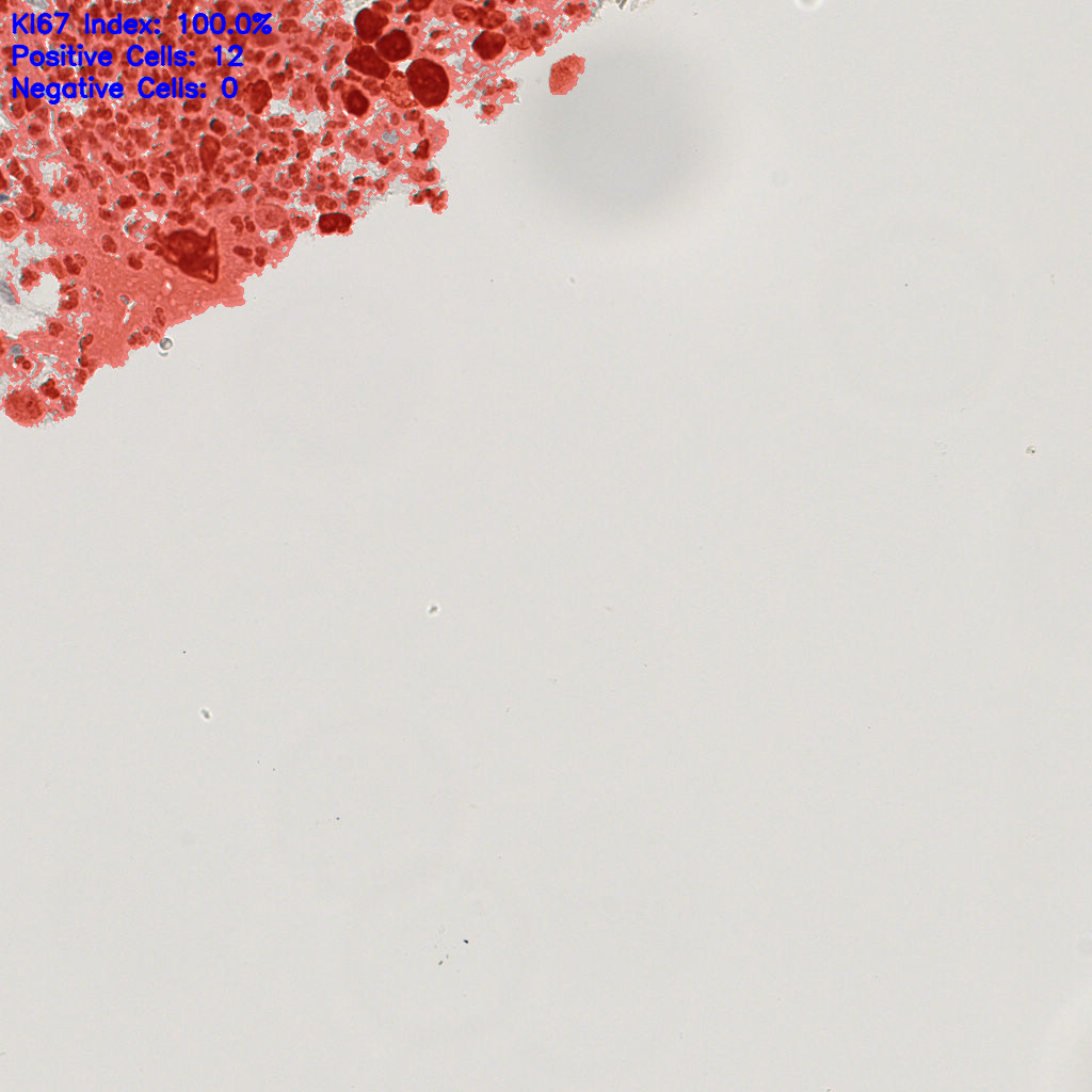 slice_19_19_x17024_y17024.png