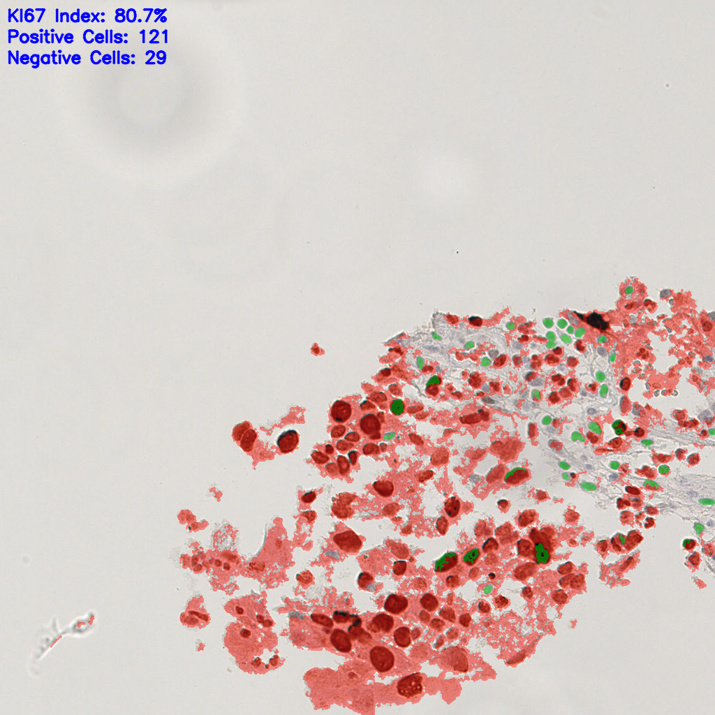slice_20_20_x17920_y17920.png