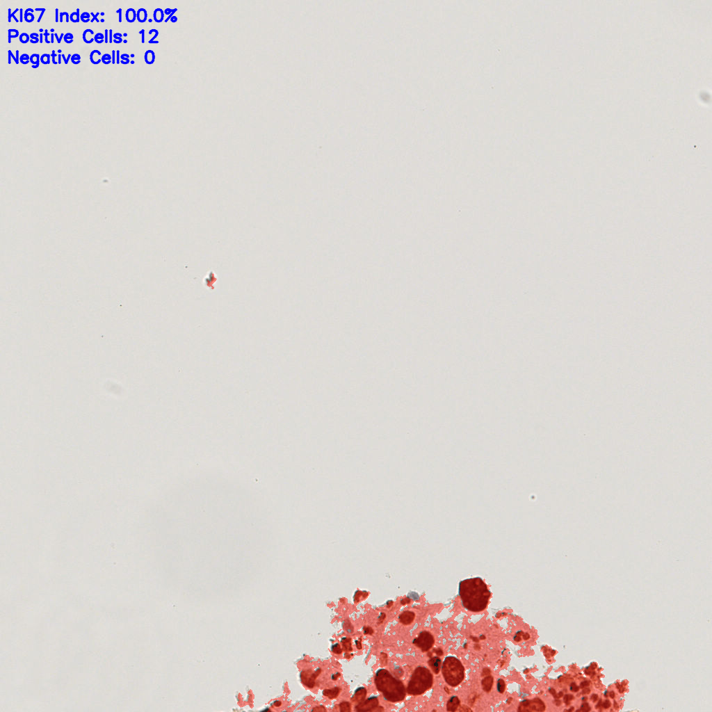 slice_22_19_x19712_y17024.png