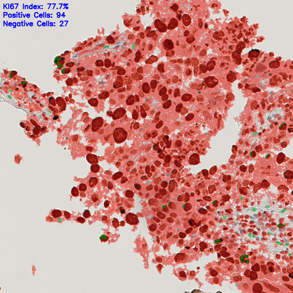 slice_22_20_x19712_y17920.png