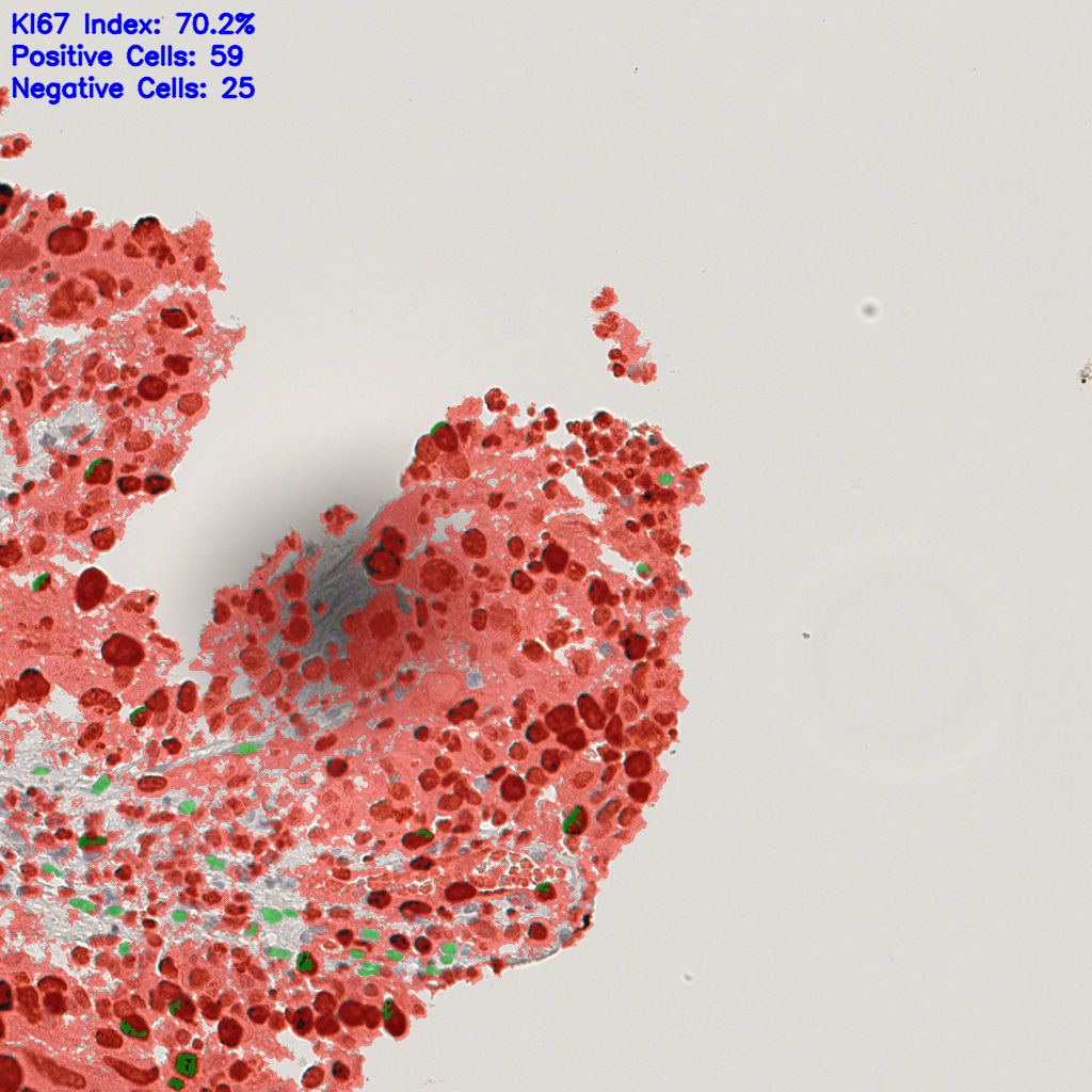 slice_23_20_x20608_y17920.png