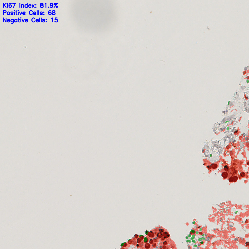 slice_37_7_x33152_y6272.png