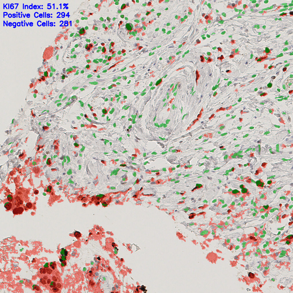 slice_38_7_x34048_y6272.png