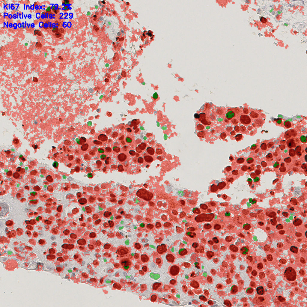 slice_38_8_x34048_y7168.png