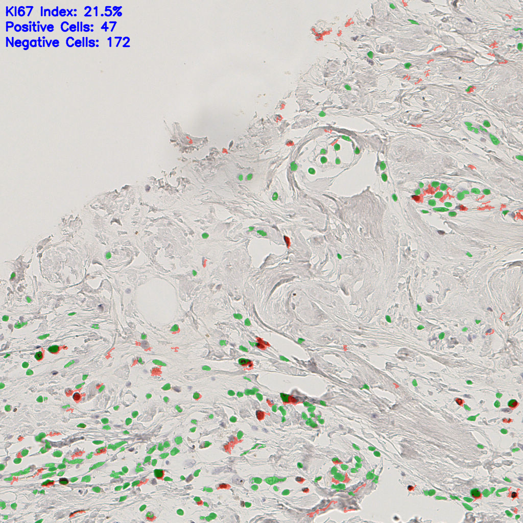 slice_39_6_x34944_y5376.png