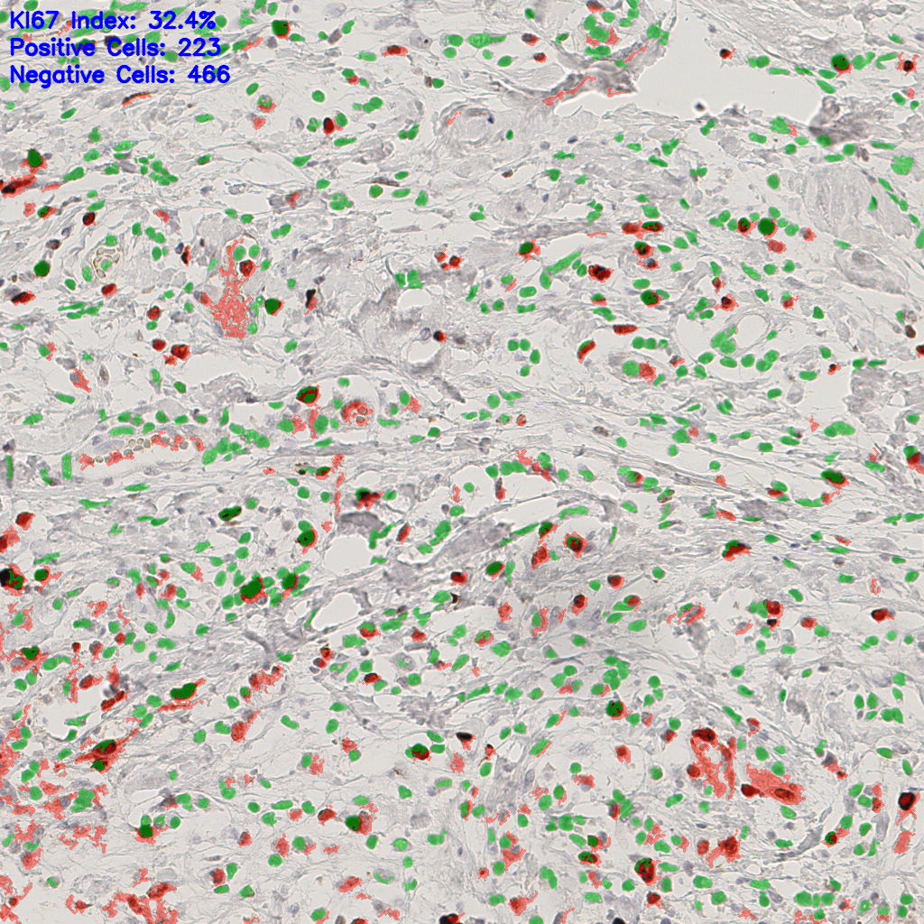 slice_39_7_x34944_y6272.png
