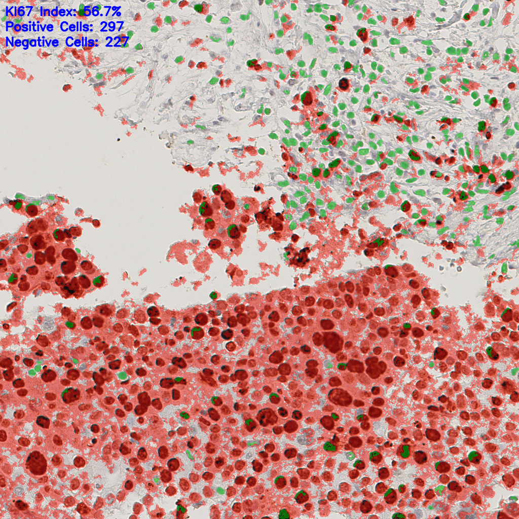 slice_39_8_x34944_y7168.png