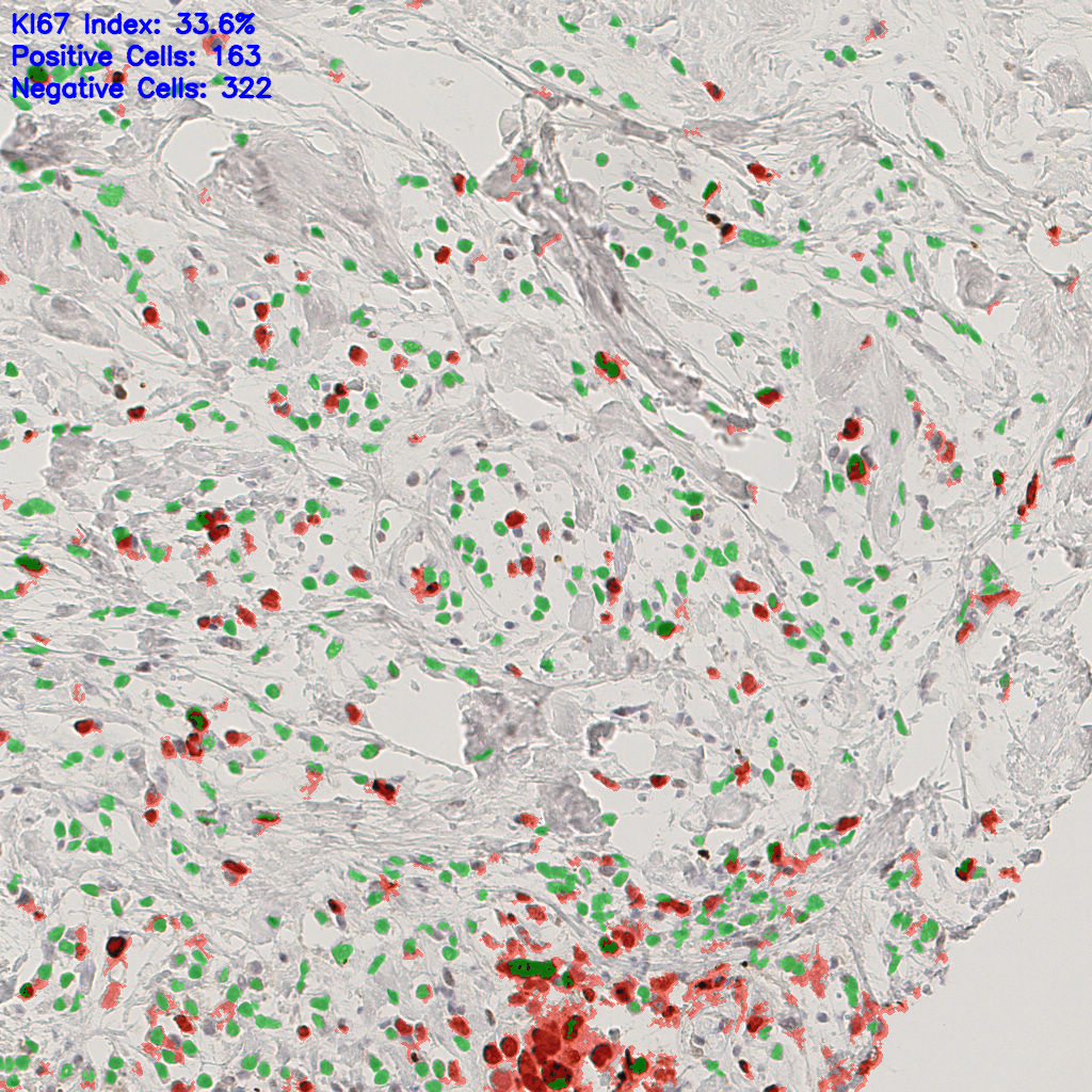 slice_40_7_x35840_y6272.png