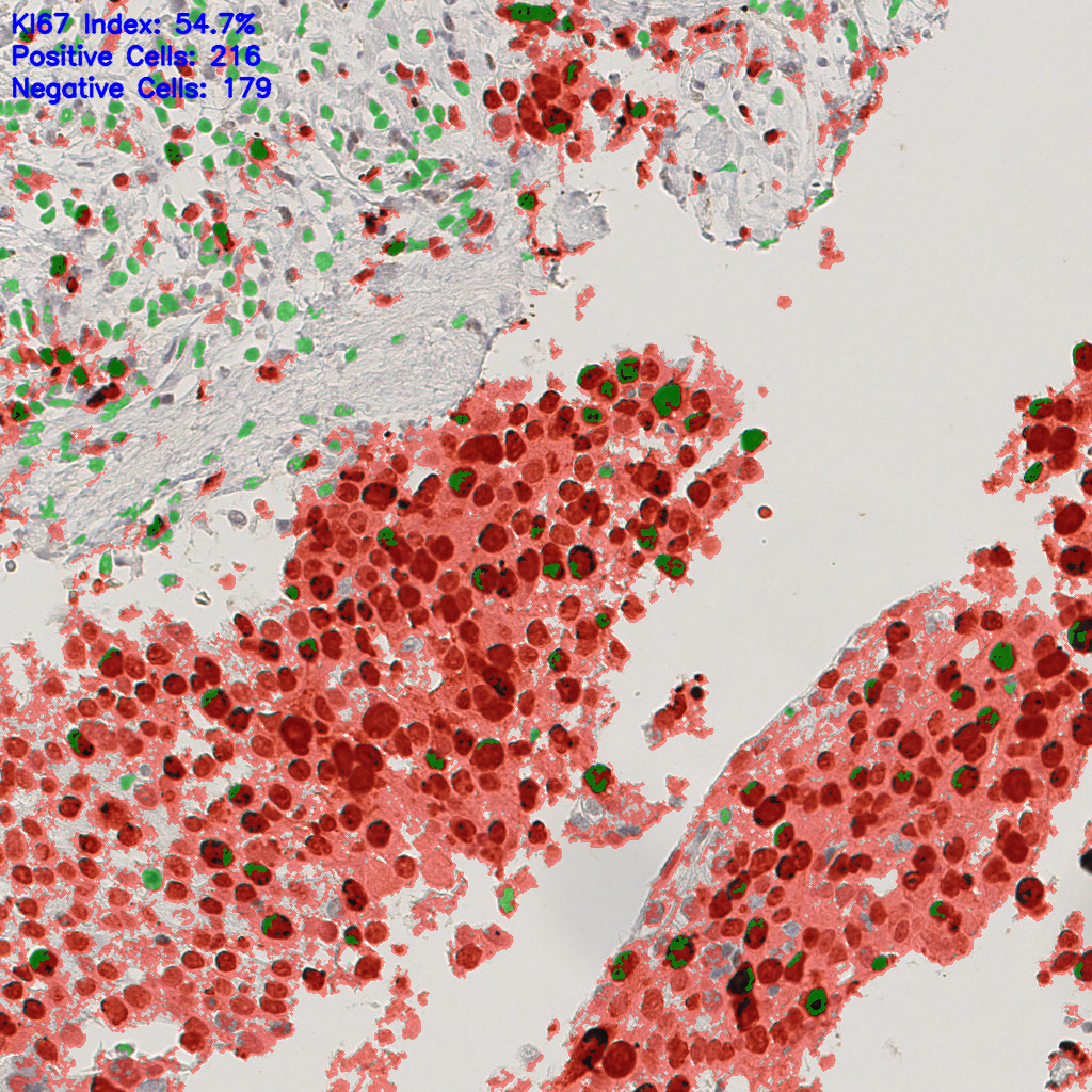 slice_40_8_x35840_y7168.png