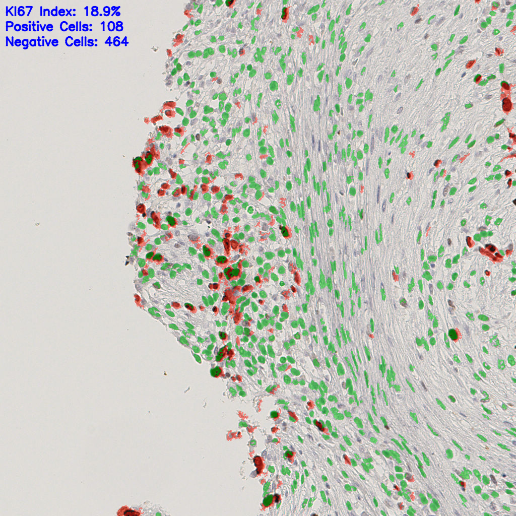 slice_41_15_x36736_y13440.png