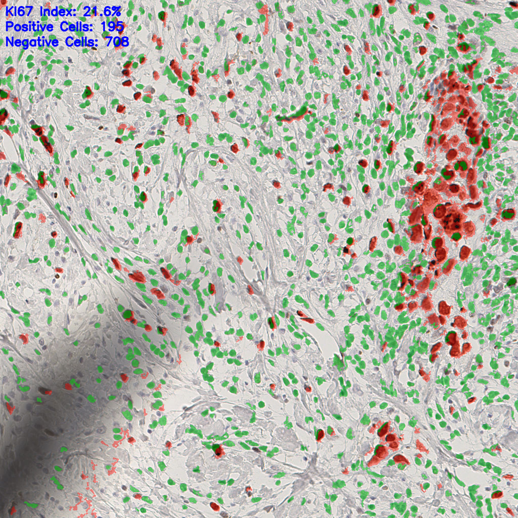 slice_41_17_x36736_y15232.png