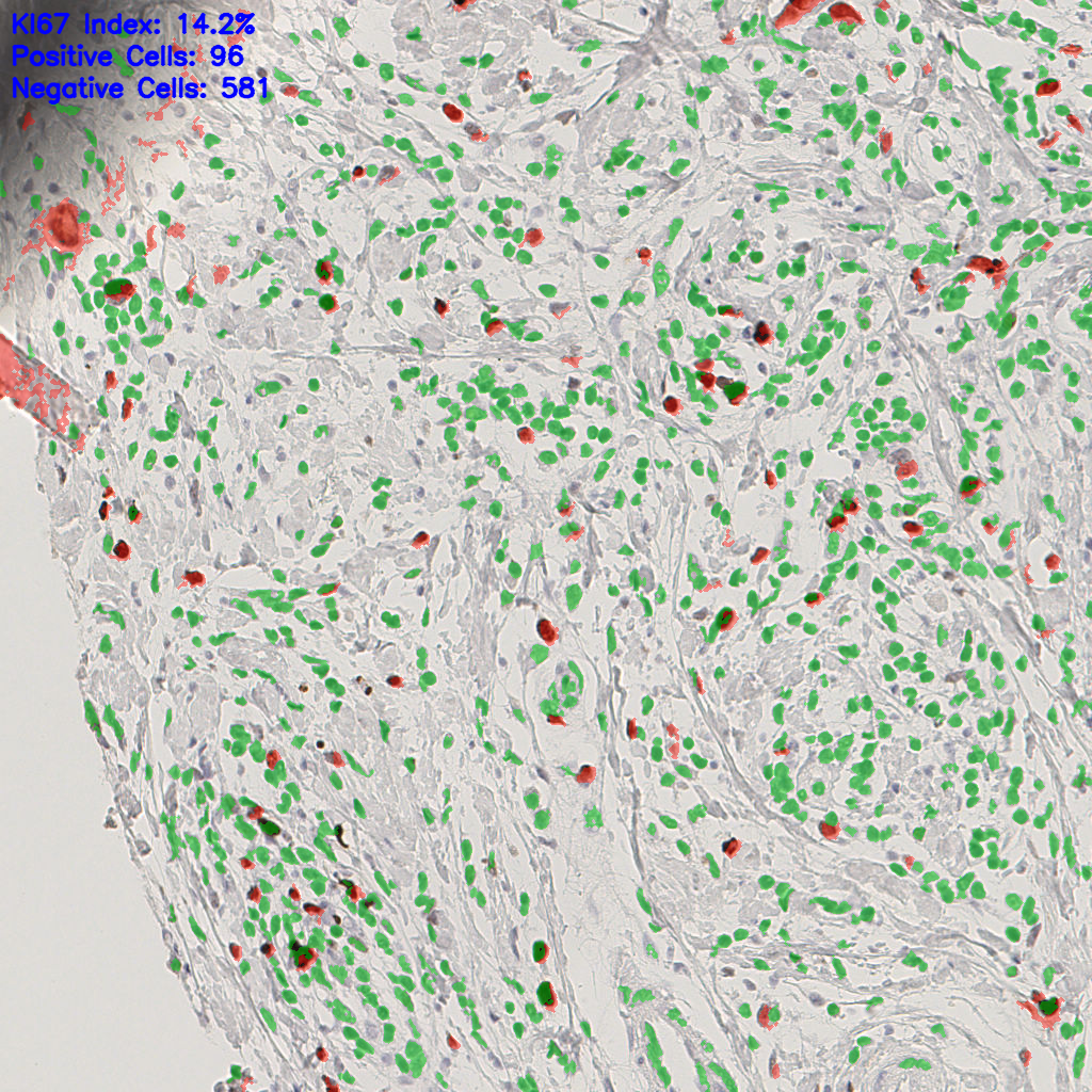 slice_41_18_x36736_y16128.png
