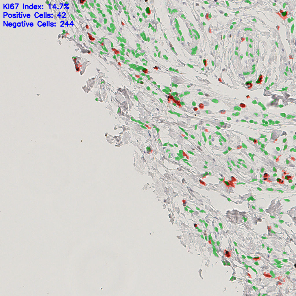 slice_41_19_x36736_y17024.png