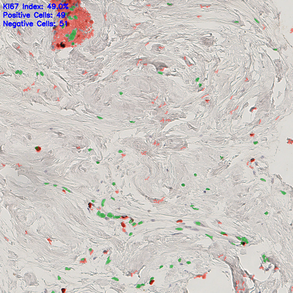 slice_41_6_x36736_y5376.png