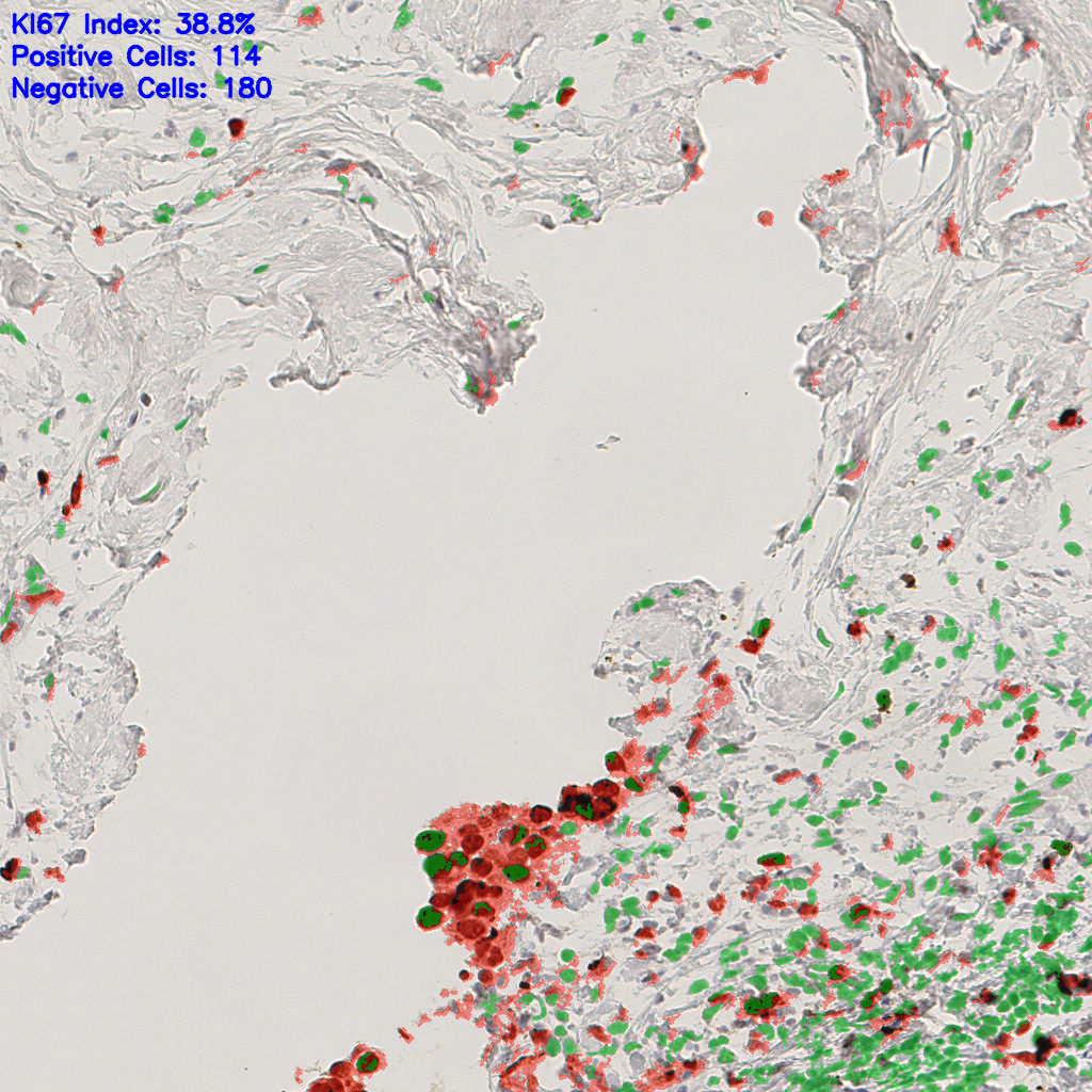 slice_41_7_x36736_y6272.png