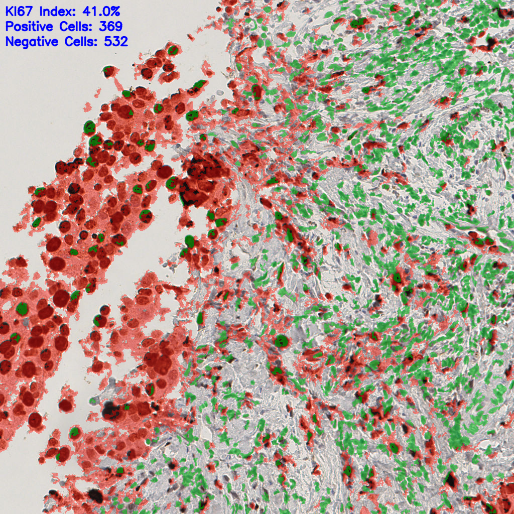 slice_41_8_x36736_y7168.png