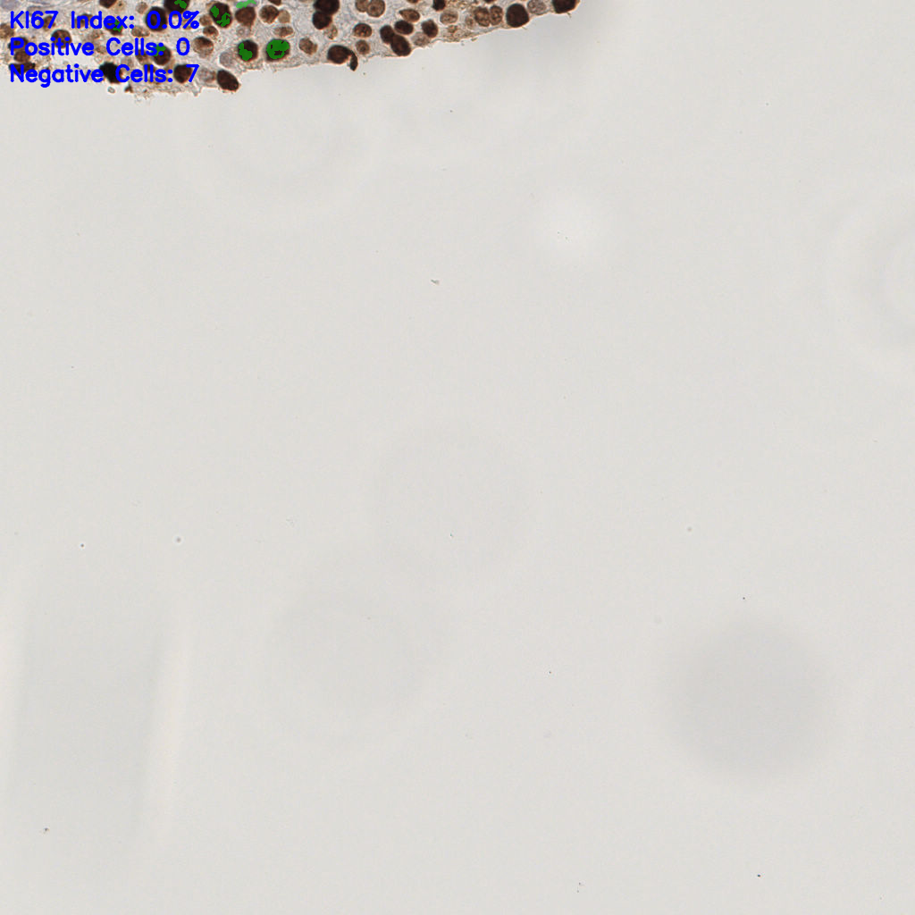 slice_42_10_x37632_y8960.png