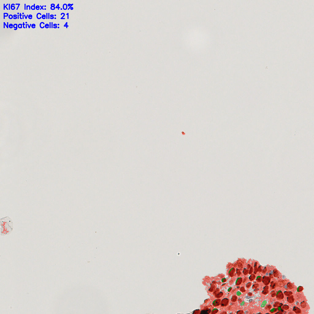slice_42_13_x37632_y11648.png