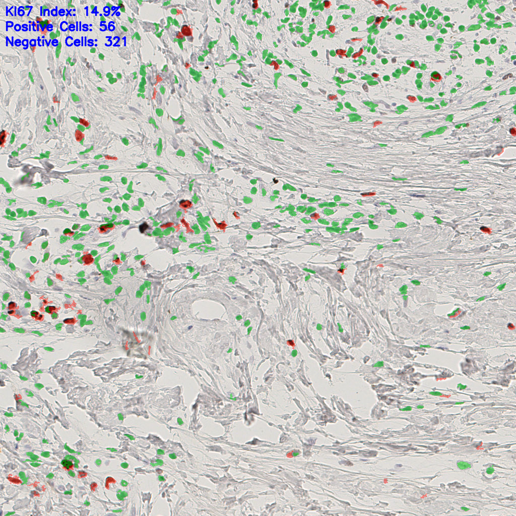 slice_42_19_x37632_y17024.png