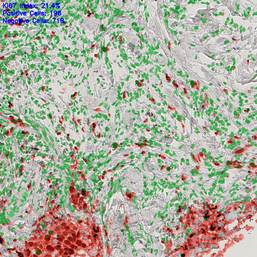 slice_42_8_x37632_y7168.png