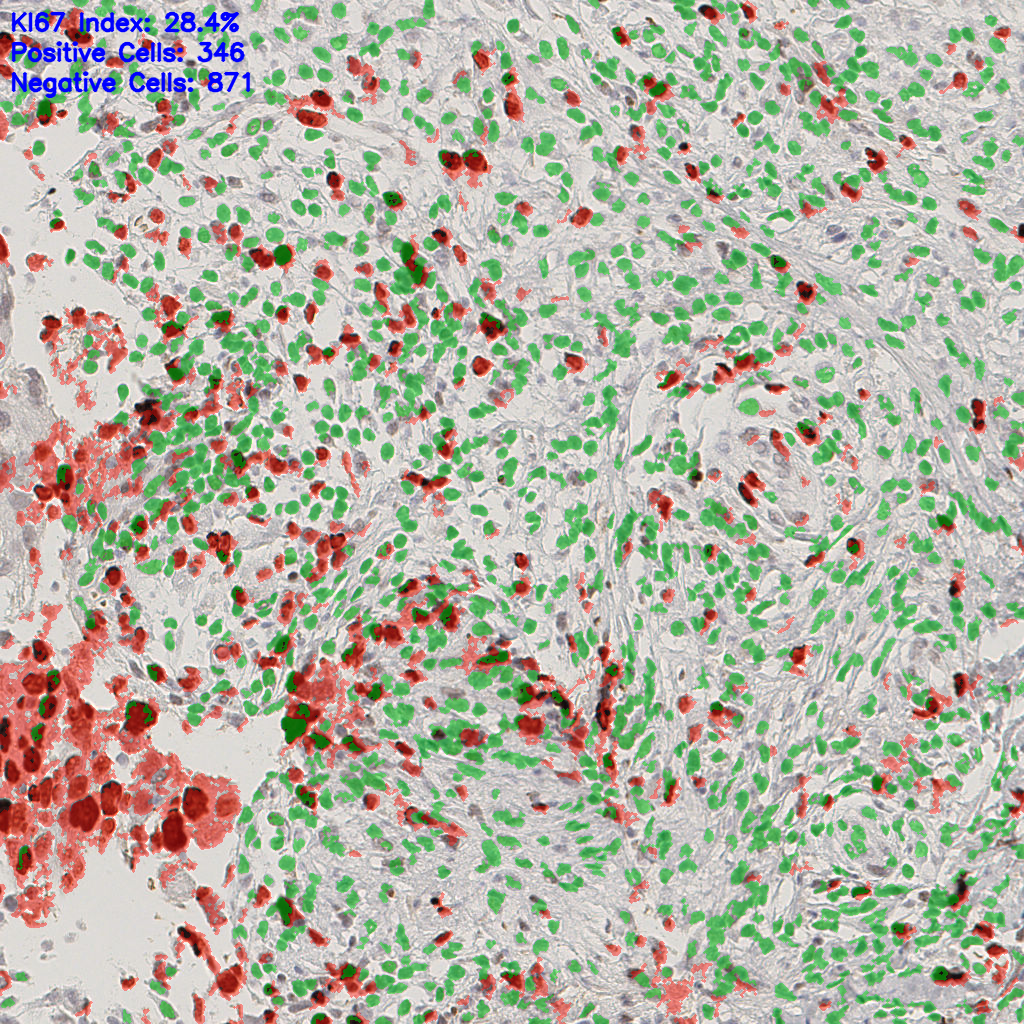 slice_43_15_x38528_y13440.png