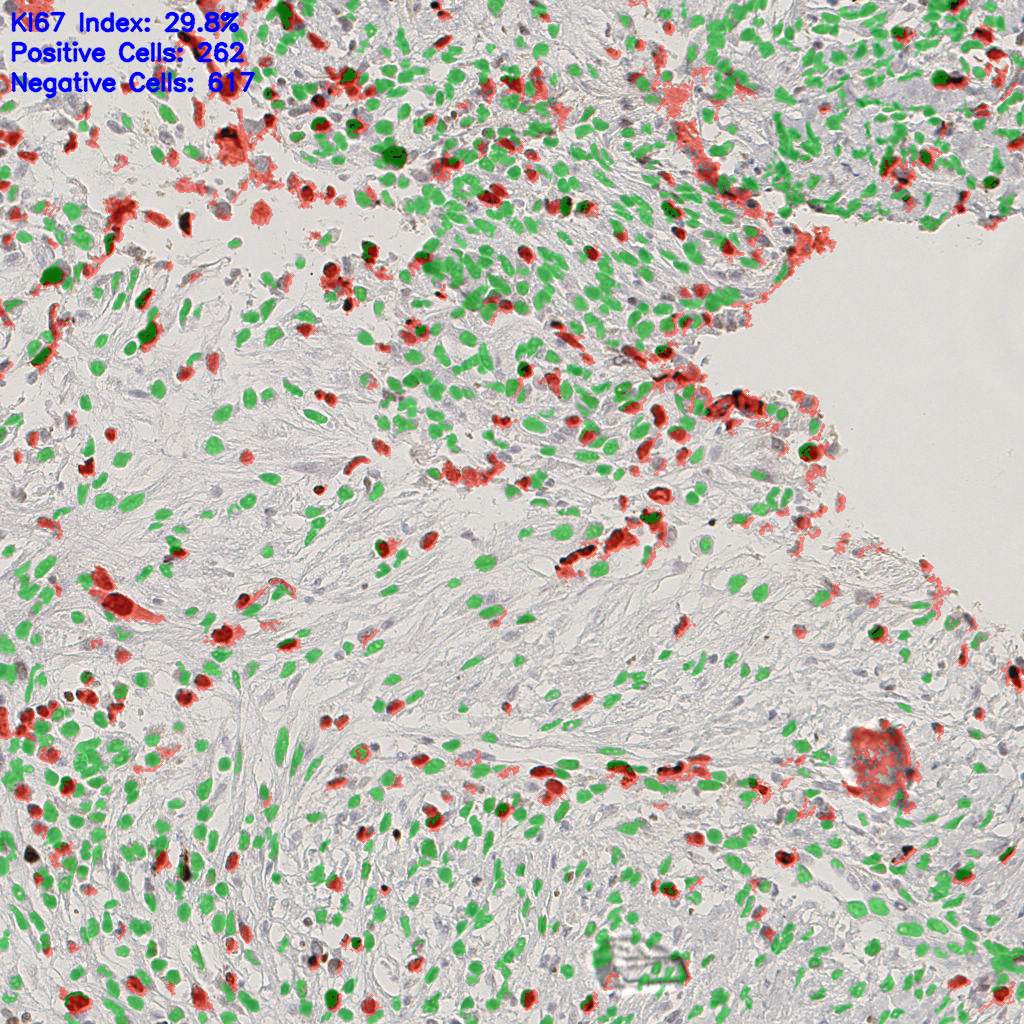 slice_43_16_x38528_y14336.png