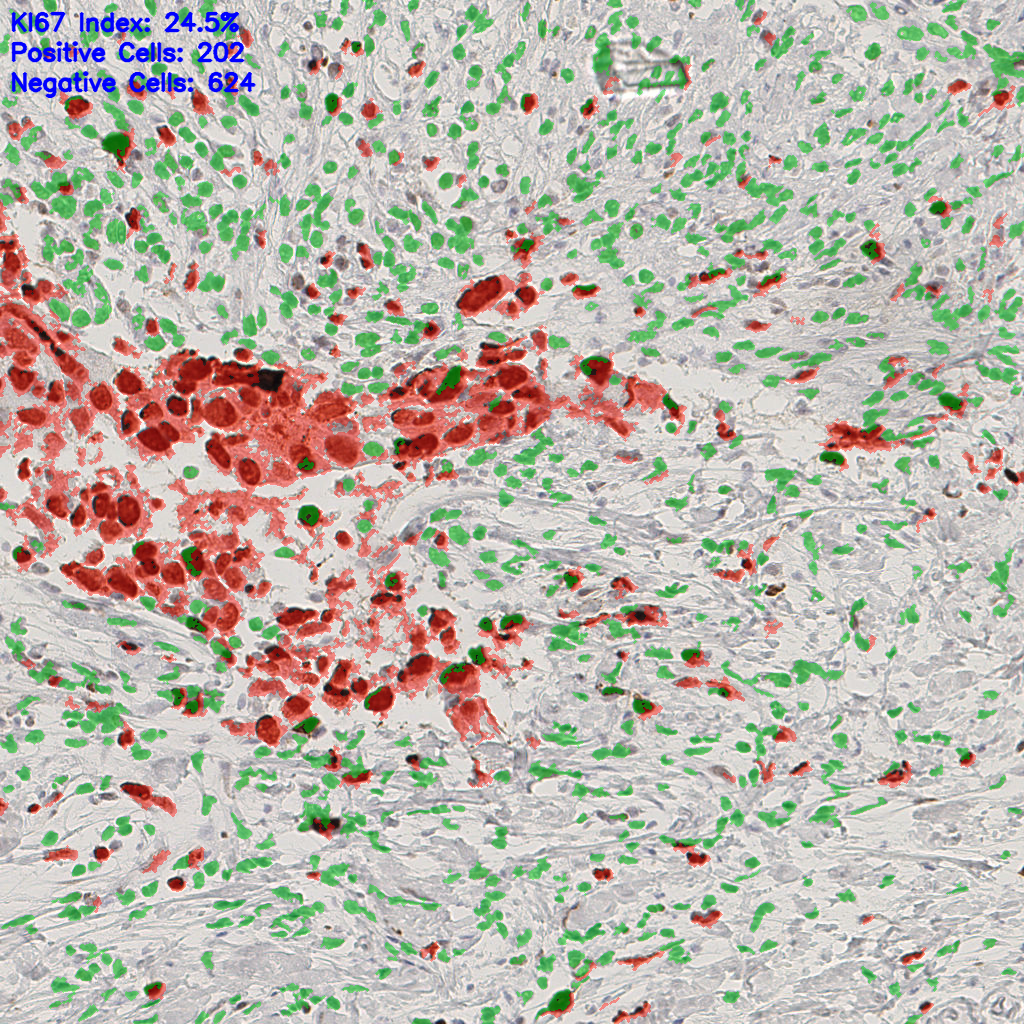 slice_43_17_x38528_y15232.png