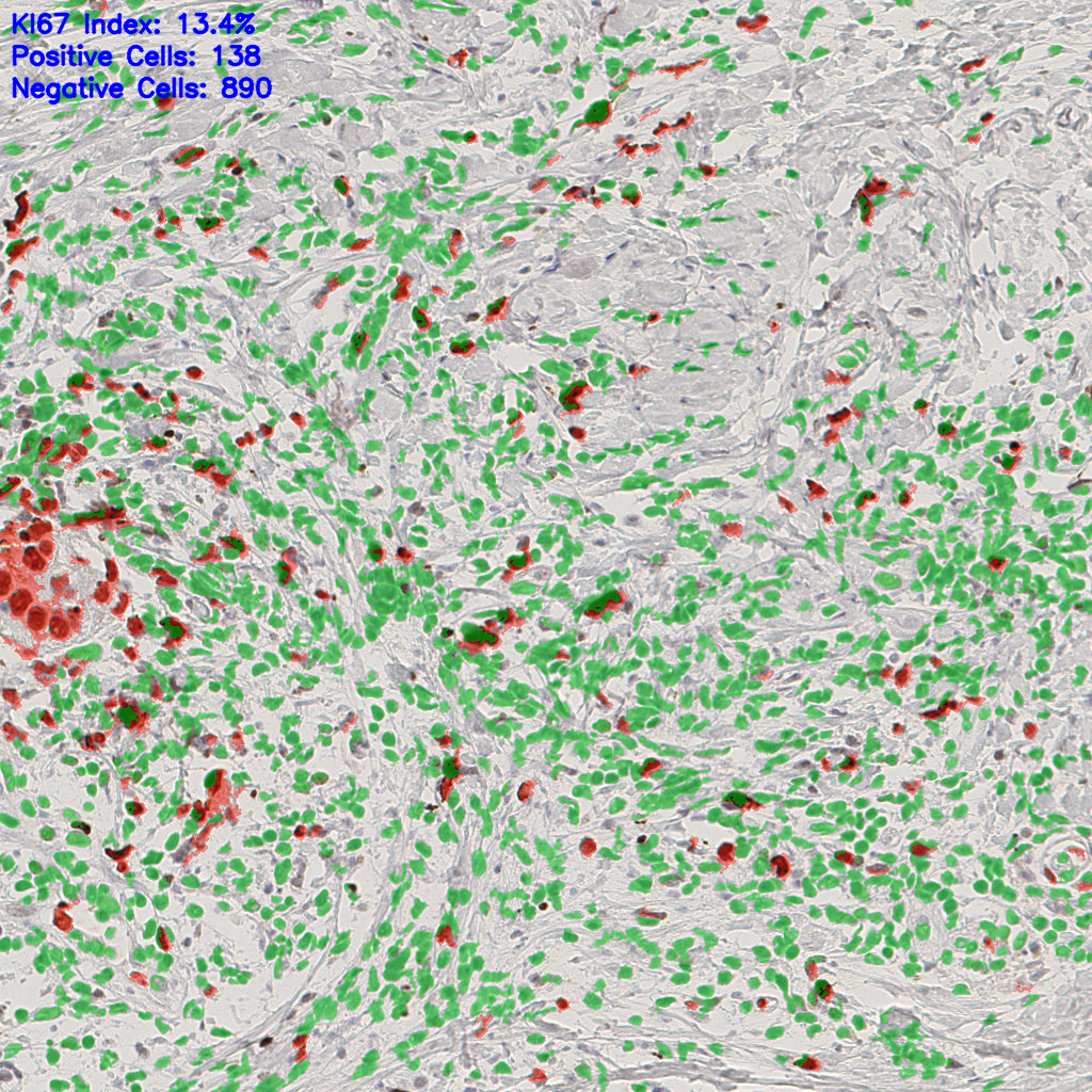 slice_43_18_x38528_y16128.png