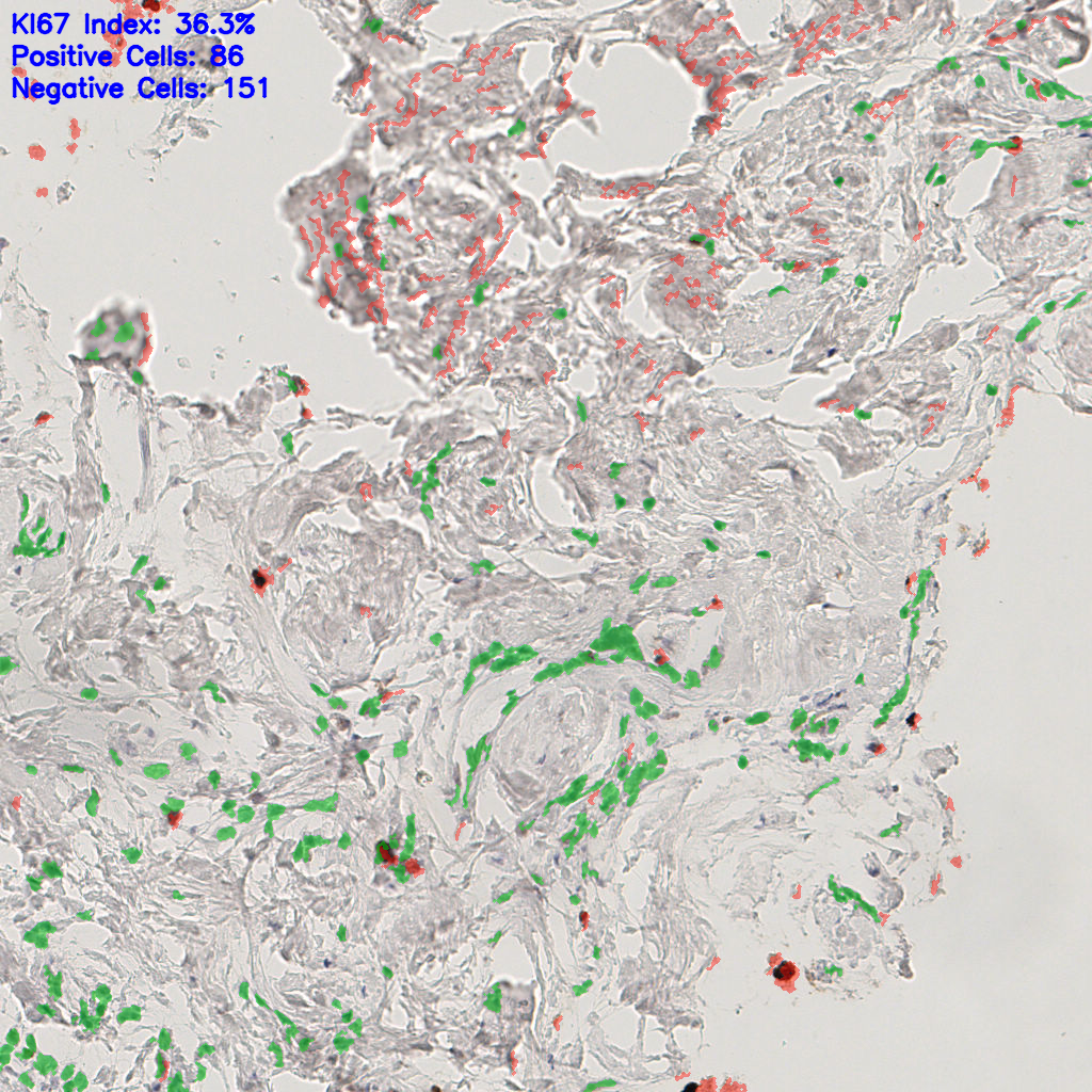 slice_43_7_x38528_y6272.png