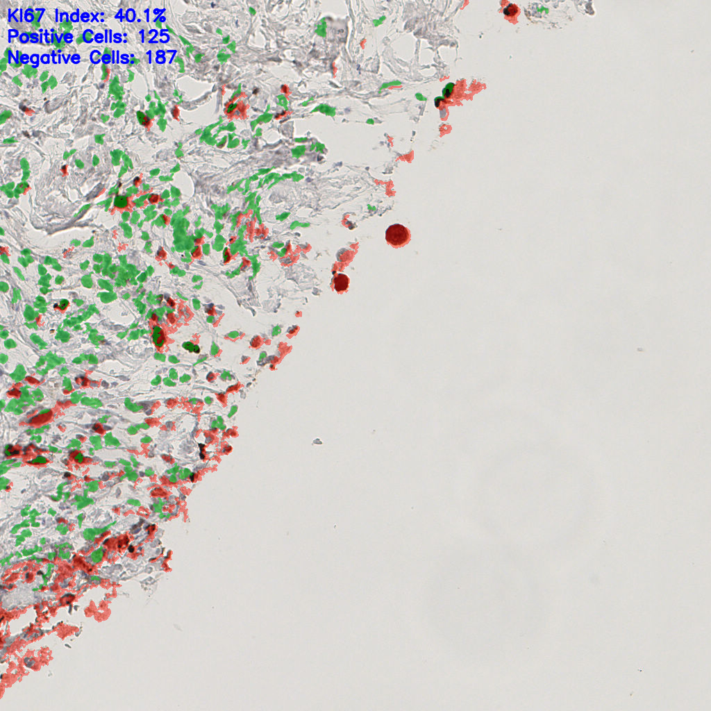 slice_43_8_x38528_y7168.png