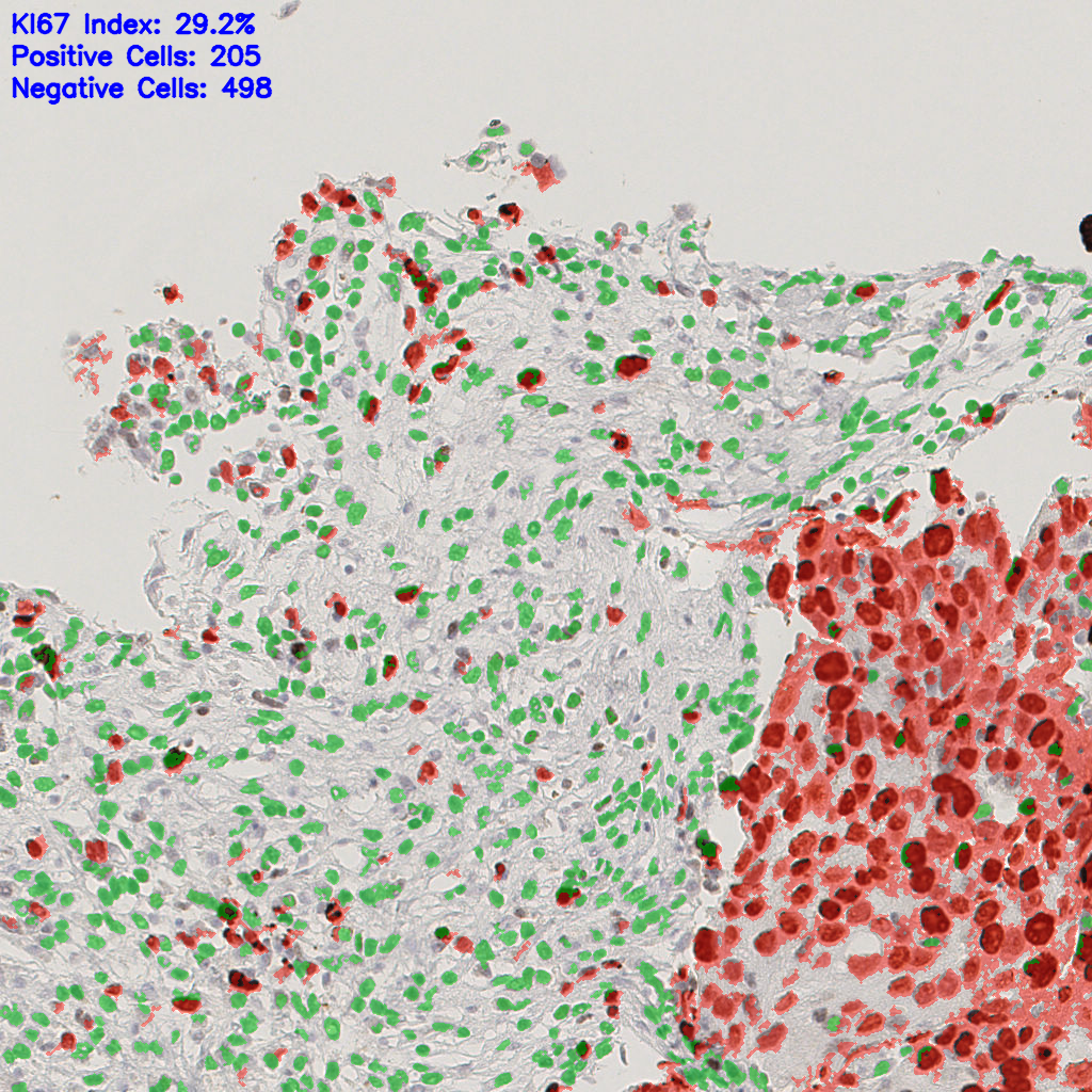 slice_44_14_x39424_y12544.png