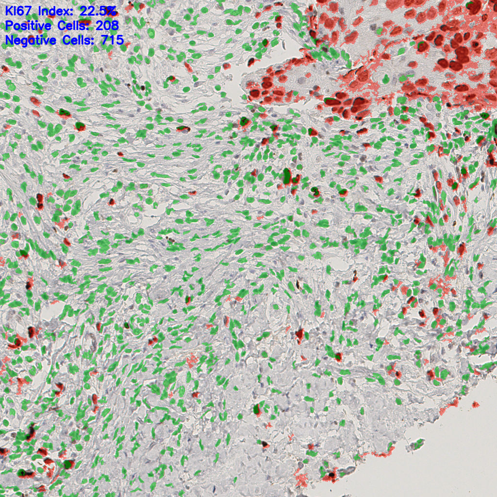 slice_44_15_x39424_y13440.png
