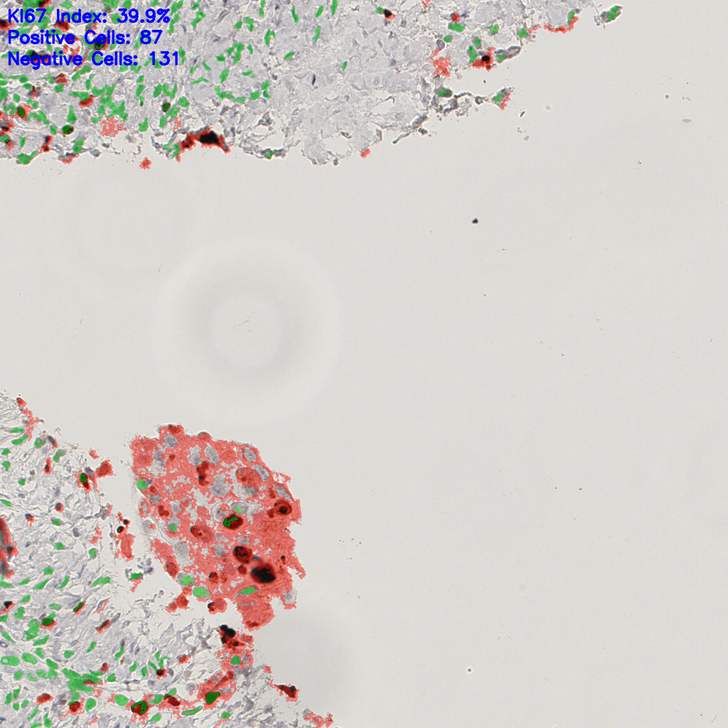 slice_44_16_x39424_y14336.png
